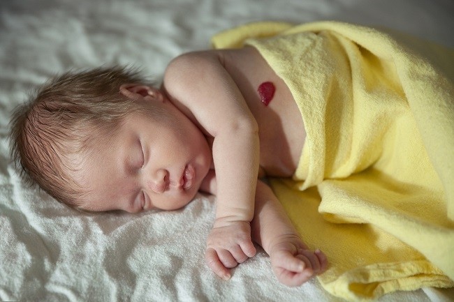 Angiome de bébé : quelles sont les différentes formes et les causes ?