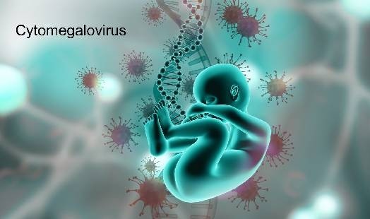 Cytomégalovirus (CMV) : Symptômes et Traitement | Conseils de ...