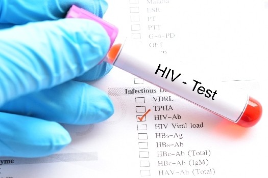 VIH et sida : symptômes, transmissions, traitements et prévention