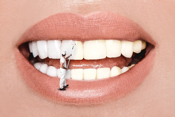 Comment blanchir ses dents rapidement sans les abîmer ?