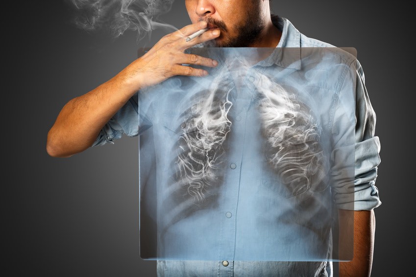 Tabac : les risques pour la santé et l'entourage - Conseils Prévention