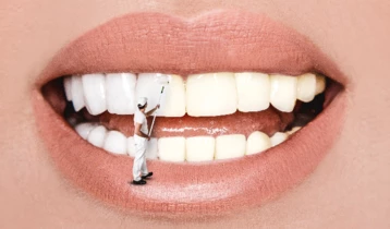 Comment blanchir ses dents ?  Les meilleures techniques