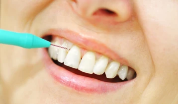 Brossettes interdentaires : comment et pourquoi les utiliser ?