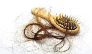 Comment réagir face à une chute de cheveux ?