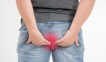 Comment soigner les hémorroïdes ?