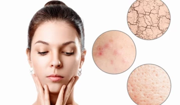 Peau mixte : comment la reconnaître et l'entretenir ?