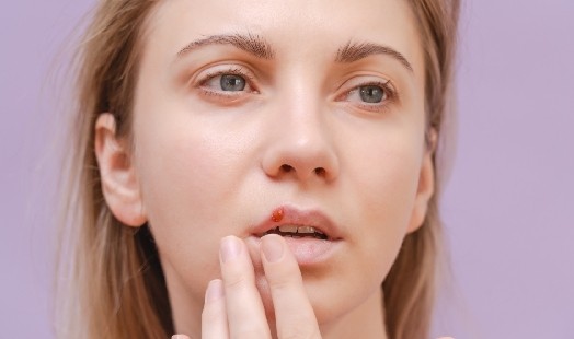 Tout savoir sur le bouton de fièvre : causes, symptômes et traitements
