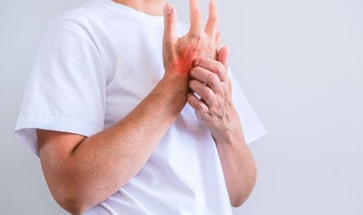 Guide complet sur la gale : symptômes, traitements et désinfection de l'environnement