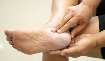 Comment prendre soin de vos pieds secs au quotidien ?