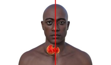 La Maladie de Basedow : symptômes, causes et traitements