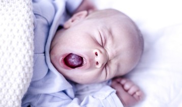 Muguet buccal du nourrisson : symptômes et traitements - Conseils Bébé