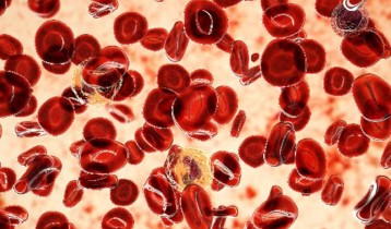 Polyglobulie : est-ce grave d’avoir trop de globules rouges ?