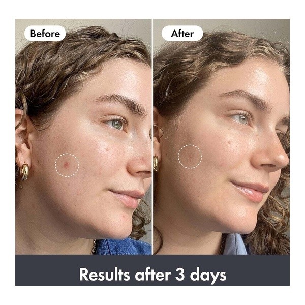 Hero Baume hydratant réparateur post imperfections