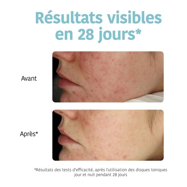 Iroha Nature disques exfoliants anti imperfections