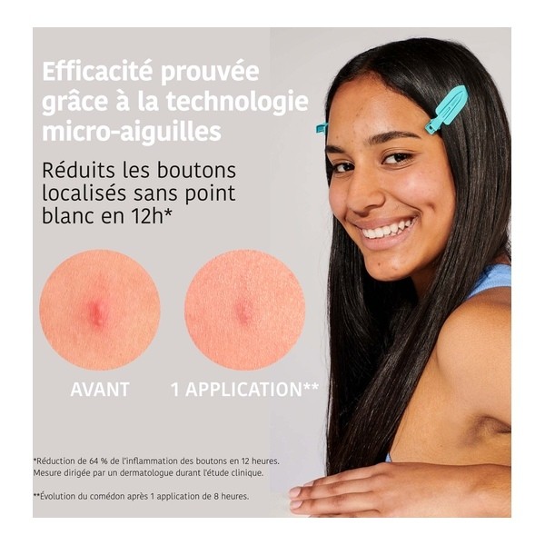 Iroha Nature Patch bouton micro cônes