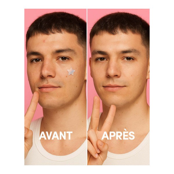 Merci Handy Patch bouton