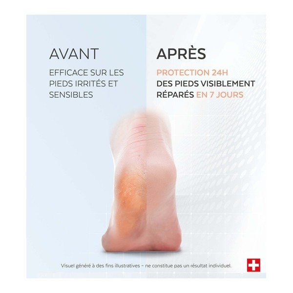 Poderm Sérum Pieds irrités et secs