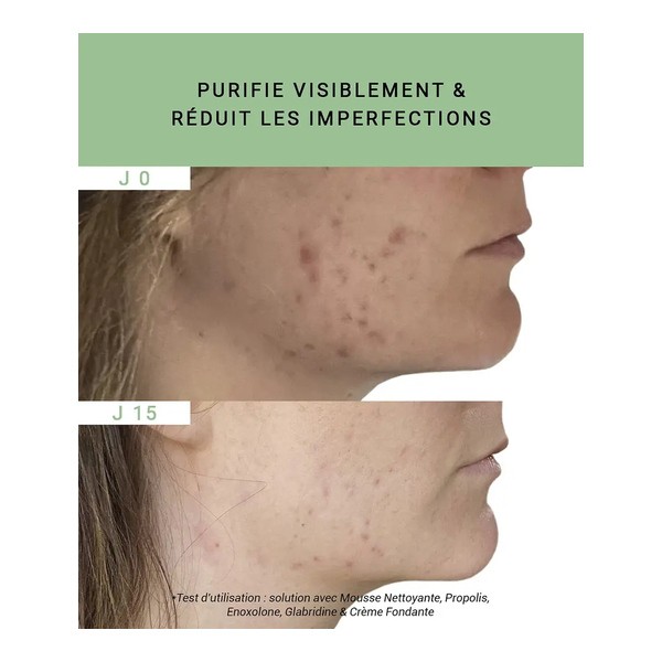 Etat pur Propolis 750ppm