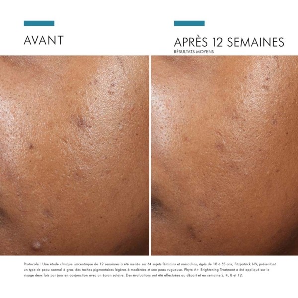 Skinceuticals Phyto A+ Brightening Treatment